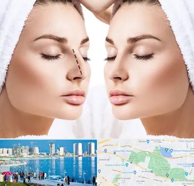 عمل بینی در چیتگر