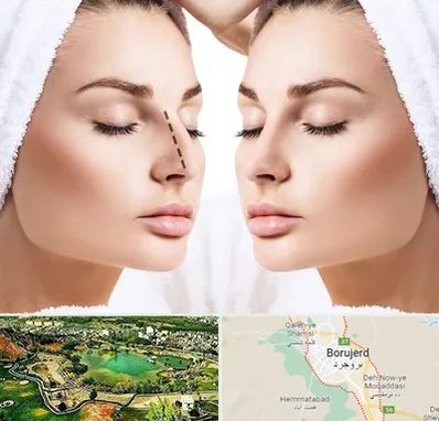 عمل بینی در بروجرد