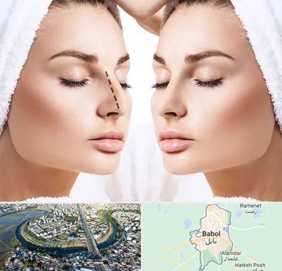 عمل بینی در بابل