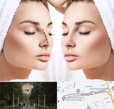 عمل بینی در بلوار معلم رشت