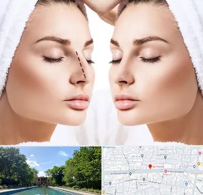 عمل بینی در هشت بهشت اصفهان