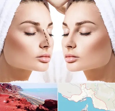 عمل بینی در هرمزگان