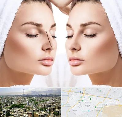 عمل بینی در منطقه 8 تهران