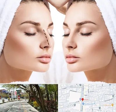 عمل بینی در خیابان توحید اصفهان