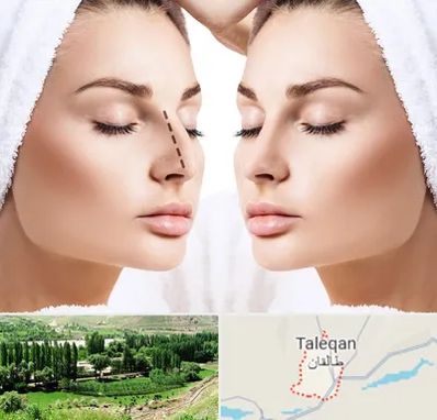 عمل بینی در طالقان