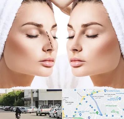 عمل بینی در قدوسی شرقی شیراز