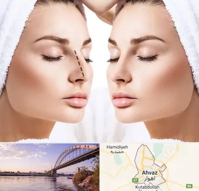 عمل بینی در اهواز