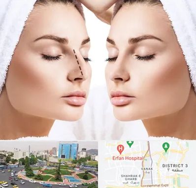 عمل بینی در ونک