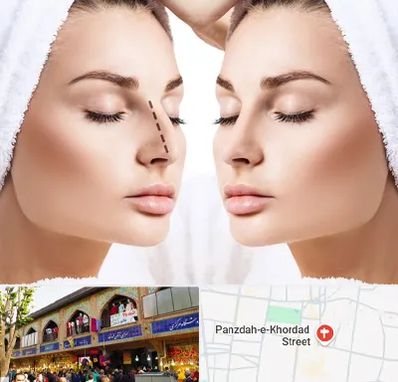 عمل بینی در 15 خرداد