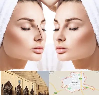 عمل بینی در ساوه