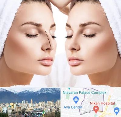 عمل بینی در آجودانیه