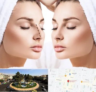 عمل بینی در هفت حوض