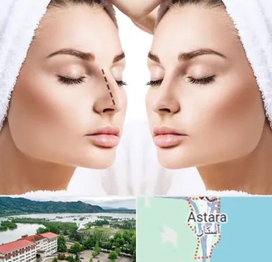 عمل بینی در آستارا