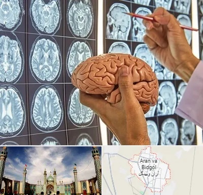 دکتر فوق تخصص جراح مغز و اعصاب در آران و بیدگل