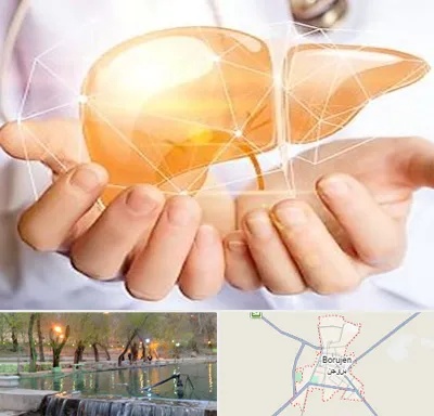 دکتر سرطان کبد در بروجن