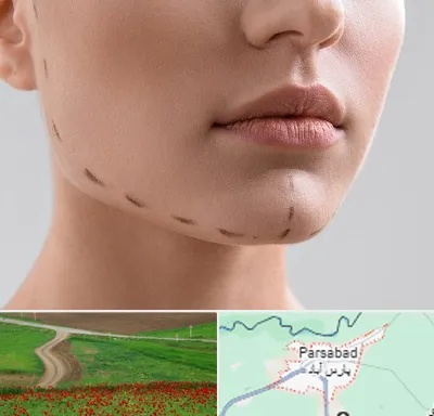 عمل زاویه فک در پارس آباد