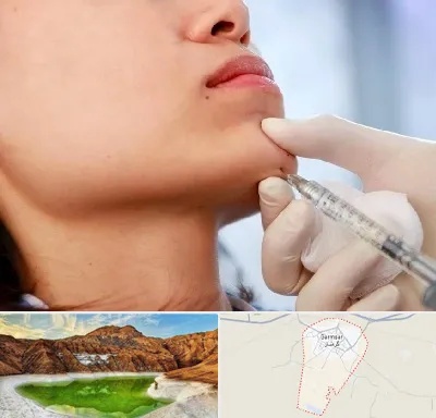زاویه سازی صورت در گرمسار