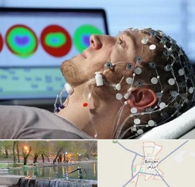 مرکز نوار مغز در بروجن