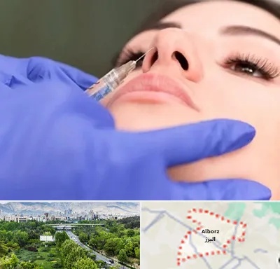 هیالاز در البرز