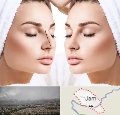 عمل بینی در جم