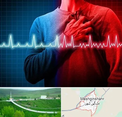 نوار قلب در مشگین شهر