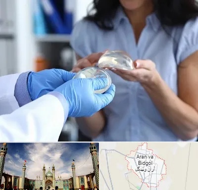 پروتز باسن در آران و بیدگل