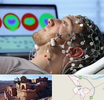 مرکز نوار مغز در قائن