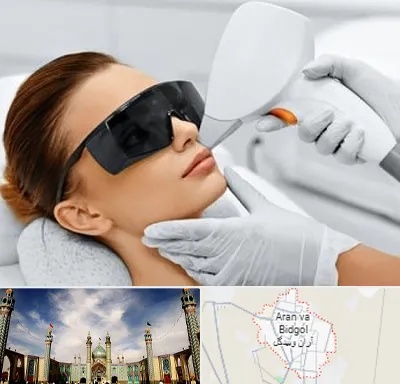 مرکز لیزر مو در آران و بیدگل