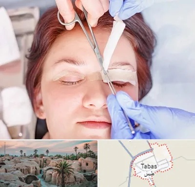 جراحی پلک افتاده در طبس