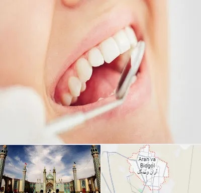 اصلاح طرح لبخند در آران و بیدگل