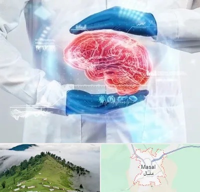 دکتر مغز و اعصاب در ماسال