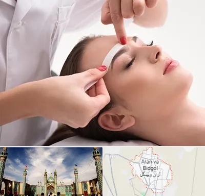 اپیلاسیون در آران و بیدگل