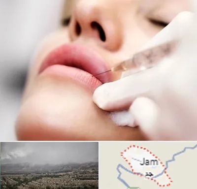 کلینیک تزریق ژل لب در جم