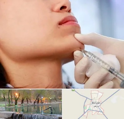 زاویه سازی صورت در بروجن