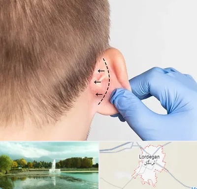 عمل زیبایی گوش در لردگان