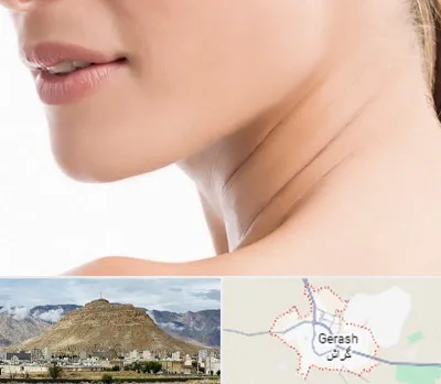 جراحی فک با لیزر در گراش