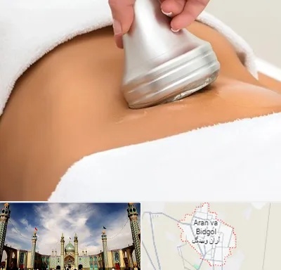دستگاه لاغری در آران و بیدگل