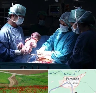 جراح سزارین در پارس آباد