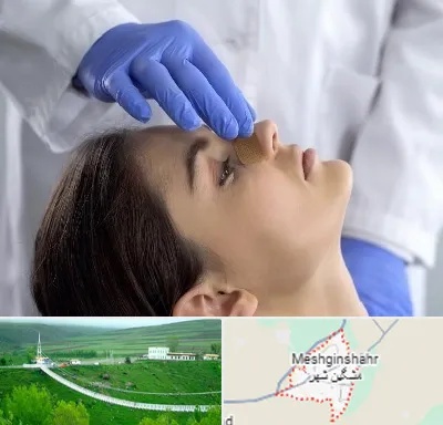 عمل بینی عروسکی در مشگین شهر