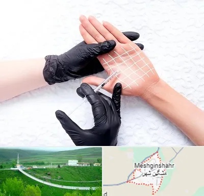 تزریق بوتاکس کف دست در مشگین شهر