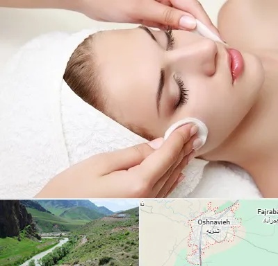 مرکز فیشیال در اشنویه