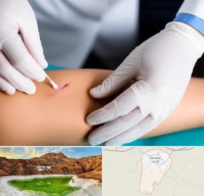 متخصص زخم عفونی در گرمسار