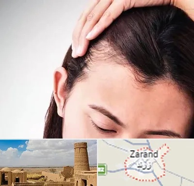 کاشت مو بانوان در زرند