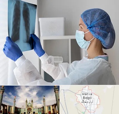 جراح سرطان مغز و استخوان در آران و بیدگل