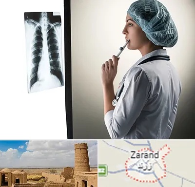 دکتر سرطان ریه در زرند