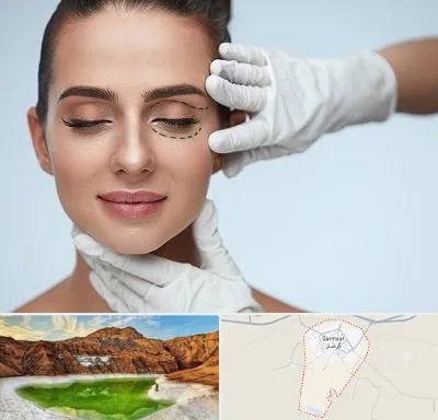 عمل پف چشم در گرمسار