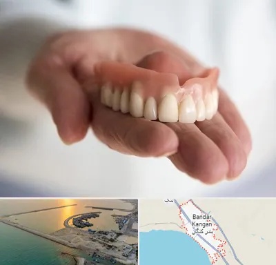 لیفت لثه با لیزر در بندر کنگان