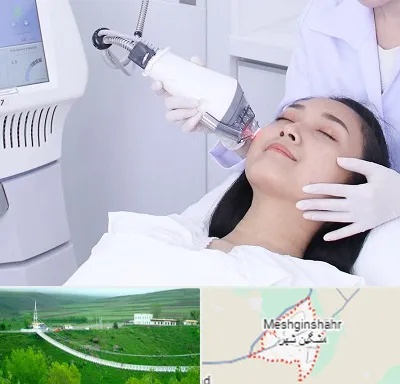 وایتنینگ در مشگین شهر