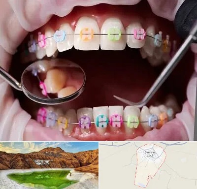 متخصص ارتودنسی در گرمسار