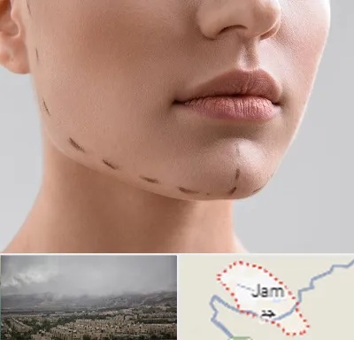 عمل زاویه فک در جم
